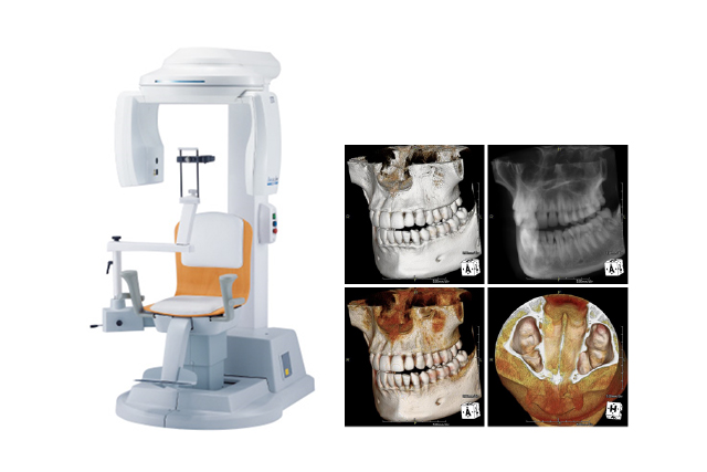 歯科用CT（Computed Tomography）